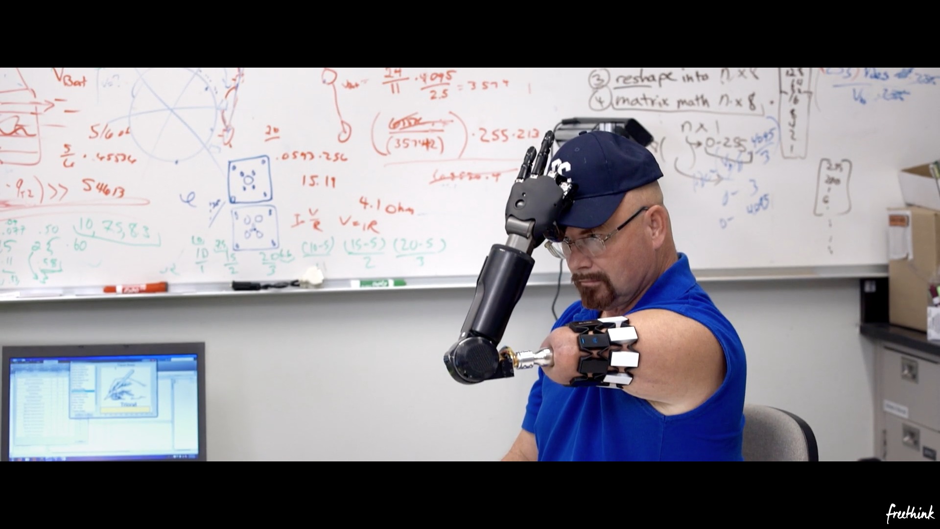 Matheny har vært på 60 minutes og kalles for verdens mest avanserte bioniske mann.
