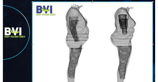 Glem BMI - her er BVI. Etter 200 år med fedmemålinger er kroppsskanneren endelig her.